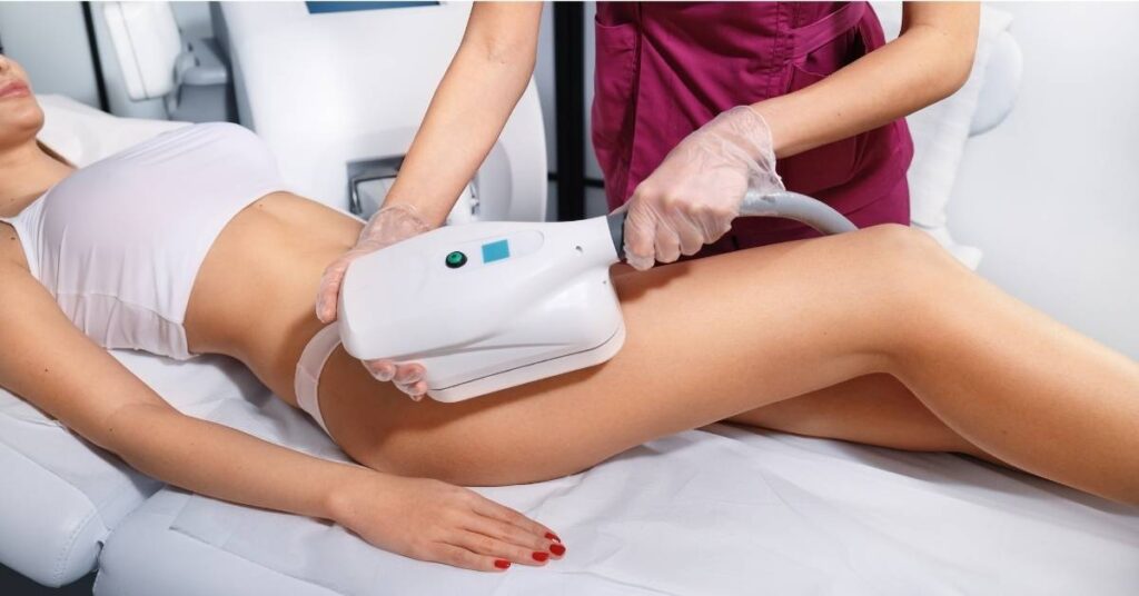 Woman receiving coolsculpting