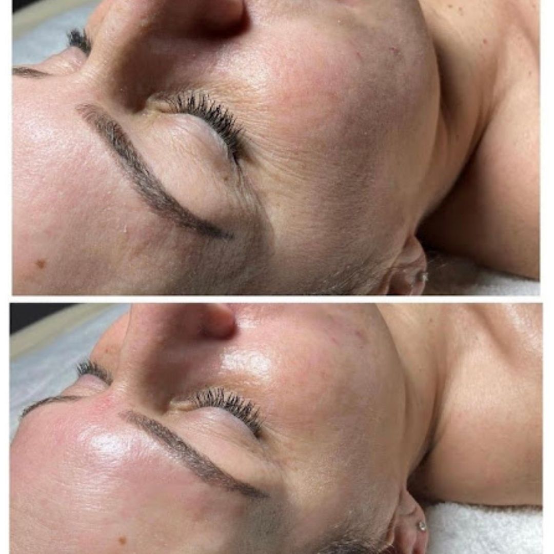 before and after a treatment