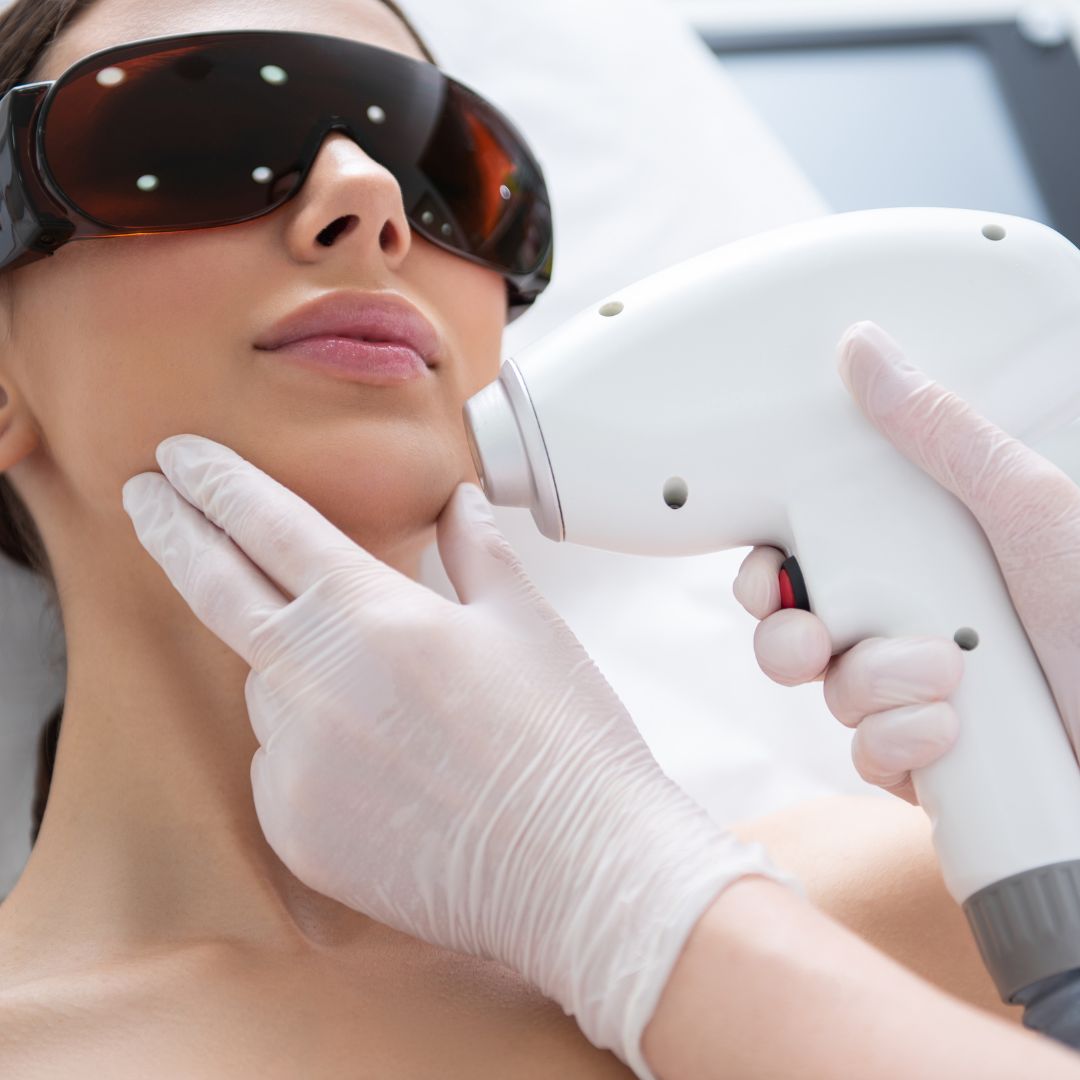 Now Is the Time for Laser Hair Removal Nu Image