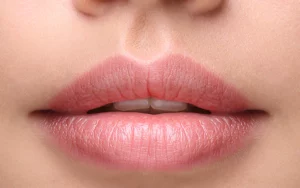 Achieving Natural-Looking Luscious Lips