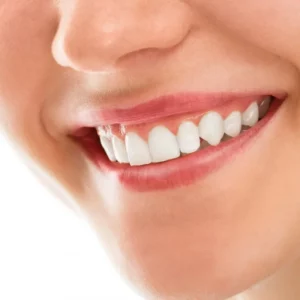 Teeth Whitening - SQ