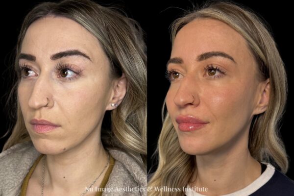 Facial Balancing-002